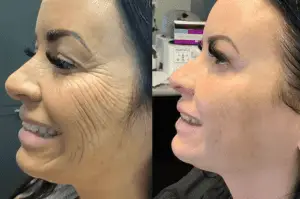 best dentist in miami,porcelain veneers miami,Botox miami,root canal cost miami,sinus lift miami,best veneers miami,best dentist south florida,best cosmetic dentist miami,best dental care miami,sage dental