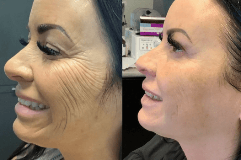 best dentist in miami,porcelain veneers miami,Botox miami,root canal cost miami,sinus lift miami,best veneers miami,best dentist south florida,best cosmetic dentist miami,best dental care miami,sage dental