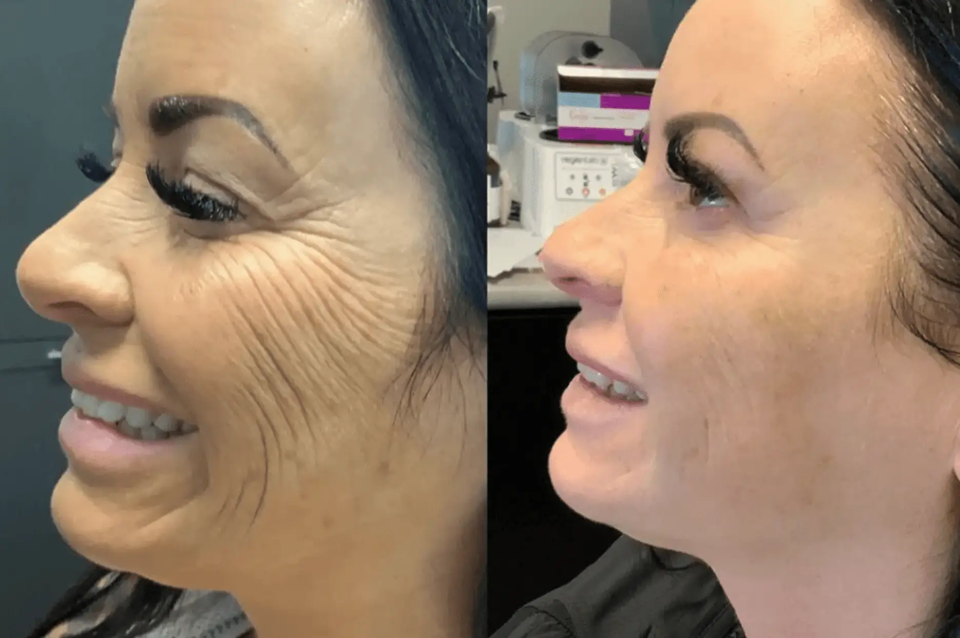 best dentist in miami,porcelain veneers miami,Botox miami,root canal cost miami,sinus lift miami,best veneers miami,best dentist south florida,best cosmetic dentist miami,best dental care miami,sage dental