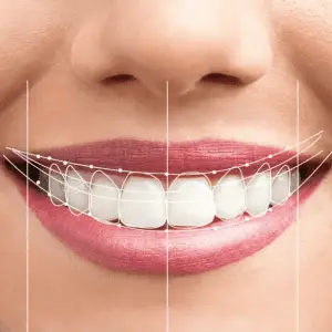 best dentist in miami,porcelain veneers miami,Botox miami,root canal cost miami,sinus lift miami,best veneers miami,best dentist south florida,best cosmetic dentist miami,best dental care miami,sage dental, g dental, dr g smile