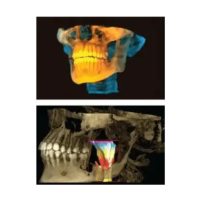 best dentist in miami,porcelain veneers miami,Botox miami,root canal cost miami,sinus lift miami,best veneers miami,best dentist south florida,best cosmetic dentist miami,best dental care miami,sage dental