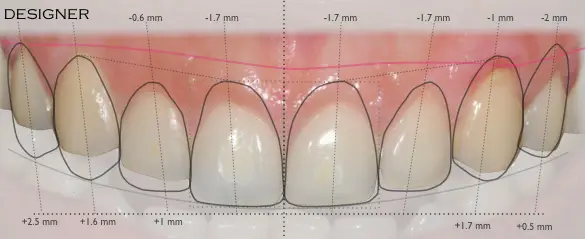 best dentist in miami,porcelain veneers miami,Botox miami,root canal cost miami,sinus lift miami,best veneers miami,best dentist south florida,best cosmetic dentist miami,best dental care miami,sage dental