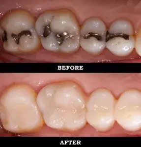 Dentist near me, dentista cerca de mi, best dentist miami, mejor dentista miami, pizza near me, chinese near me, food near me, crown dentist miami, cheapest dentist miami, root canal dentist miami, cheapest root canal miami