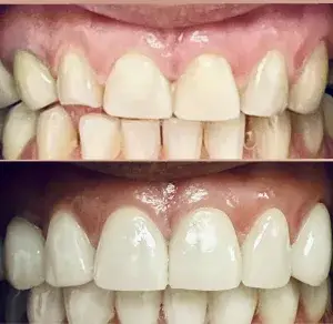 General Dentist with microscope, dentist near me, dentista near me, dentista cerca de mi, Miami dentist, Woman Dentist Miami, Woman dental near me, mujer dentista miami