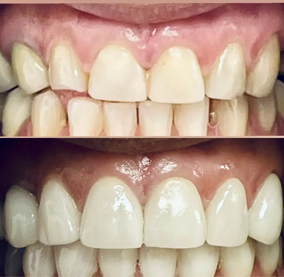 Dentista general con microscopio, dentista cerca de mí, dentista cerca de mí, dentista en Miami, dentista para mujeres en Miami, dentista para mujeres cerca de mí, mujer dentista en Miami