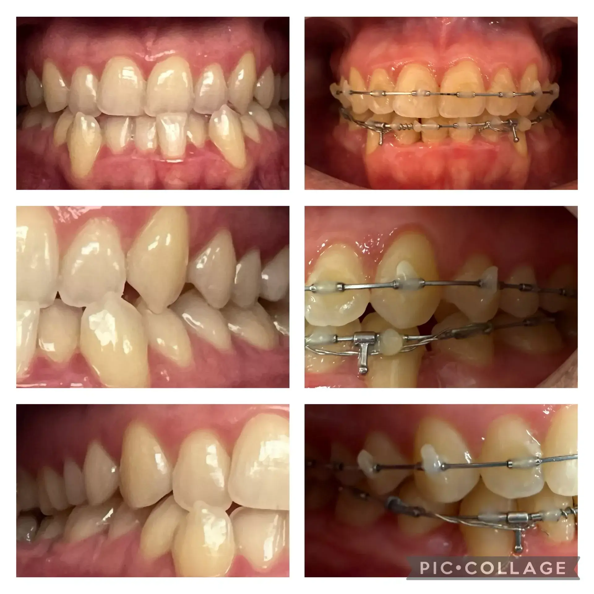 Mejor dentista Miami | Mujer Dentista Miami | dentista cerca de mí | dentista alrededor de mi | Dentista Miami | Dentista Miami | pizza cerca de mí Miami | comida cerca de mi Miami | chino cerca de mi miami | Dentistas más baratos en Miami | Los 10 mejores dentistas de Miami | Mejor cirujano bucal de miami | implantes más baratos miami | implantes miami | cirujano oral cerca de mí | cuanto cuestan los implantes miami | elevación de seno miami | los 10 mejores cirujanos bucales de miami | Mejor cirujano bucal de miami | implantes más baratos miami | implantes miami | cirujano oral cerca de mí | cuanto cuestan los implantes miami | elevación de seno miami | Los 10 mejores cirujanos bucales de Miami | Morfeo 8 Miami | Morfeo8 Miami | Morfeo8Miami | Morfeo 8Miami | invisalign miami | invisalign cerca de miami | brackets más baratos miami | mejores aparatos ortopédicos para dentistas en miami | carillas más baratas Miami | mejores carillas Miami | carillas de porcelana miami | carillas cerca de mí | dentista corona miami | dentista de corona más barato Miami | relleno de cavidades Miami | me duele el diente miami | dentista cerca | dentista cerca | Bótox miami | mejor botox medspa miami | unidad de botox más barata Miami | aceptando nuevos pacientes dentista miami | invisalign miami | invisalign cerca de miami | soportes más baratos miami | mejores aparatos ortopédicos para dentistas en miami | carillas más baratas Miami | mejores carillas Miami | carillas de porcelana miami | carillas cerca de mí | dentista corona miami | dentista de corona más barato de Miami | relleno de cavidades Miami | me duele el diente miami | dentista cerca | dentista cerca | Botox miami | mejor botox medspa miami | unidad de botox más barata Miami | aceptando nuevos pacientes dentista miami